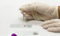 Mão com luva cirúrgica branca fazendo teste de ISTs sem sintomas, colocando gota de sangue em placa petri.