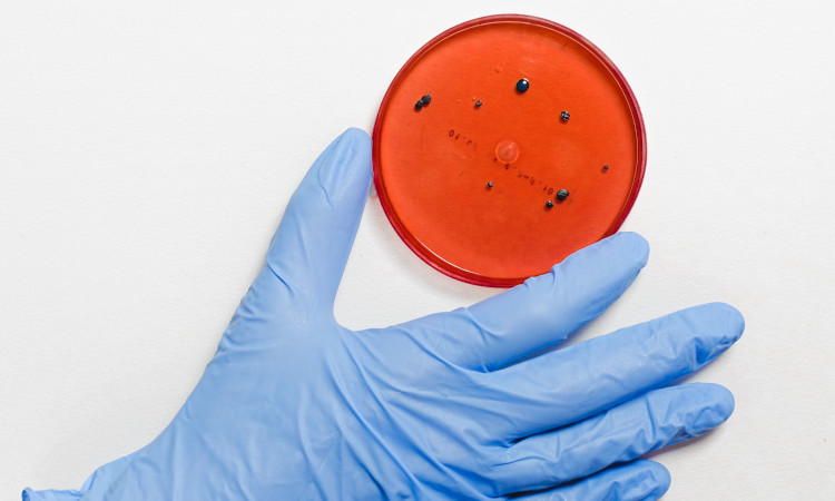 Mão com luva cirúrgica azul segurando placa de petri com culturas bacterianas de clamídia ou gonorreia. 