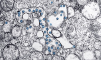 Pequenas bolhas de bactérias em azul e cinzento representando testagem de como saber se tenho IST.