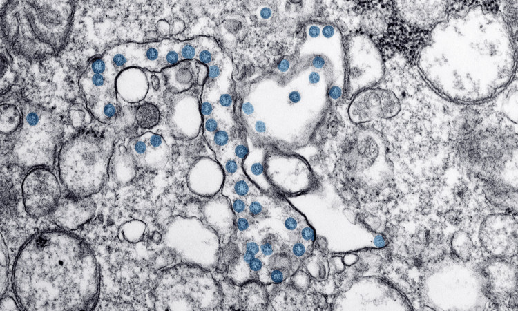 Pequenas bolhas de bactérias em azul e cinzento representando testagem de como saber se tenho IST.